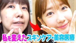 AKB48柏木由紀：ゆきりんワールドが「【美容医療】初！やってよかった美容医療・スキンケアをお話しします！」を公開